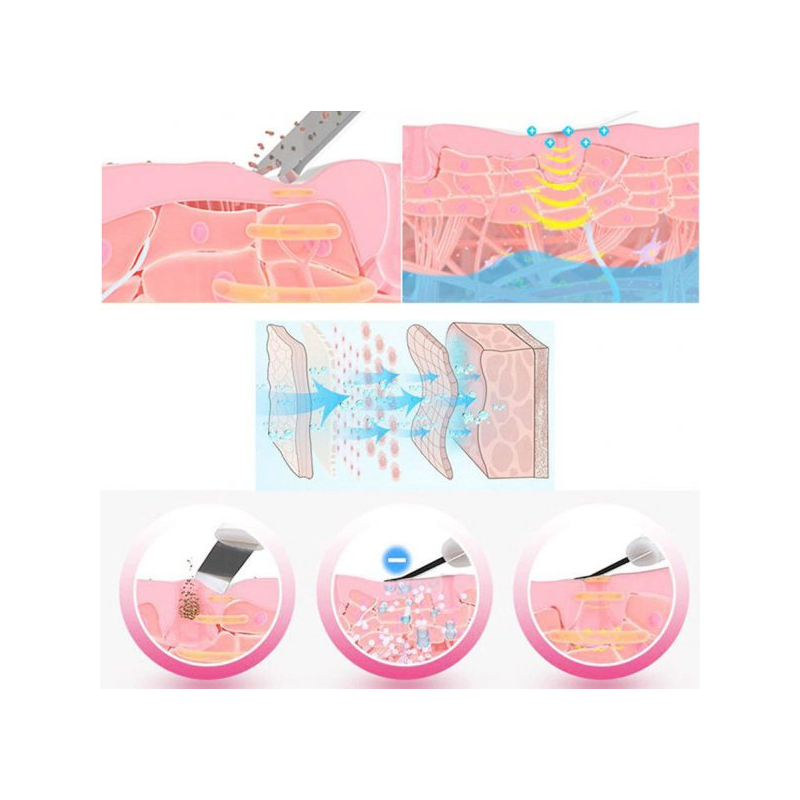 Ултразвуков фриматор за лице J618