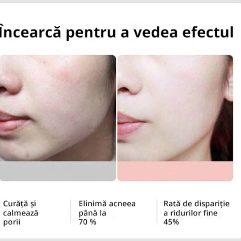 Многофункционален уред за лице 5 в 1